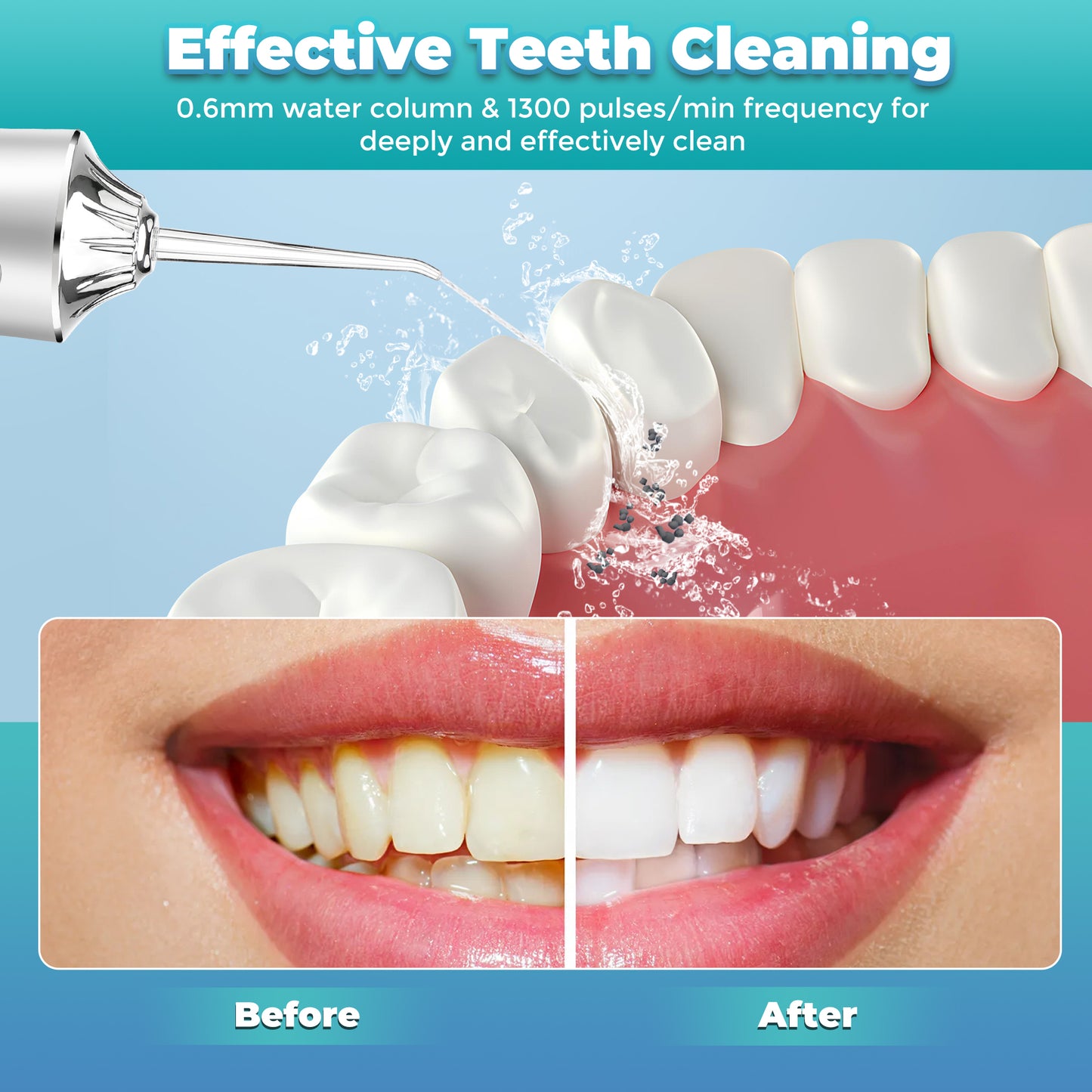 Electric Water Flosser